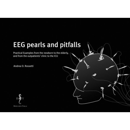 EEG pearls and pitfalls (E-Book)