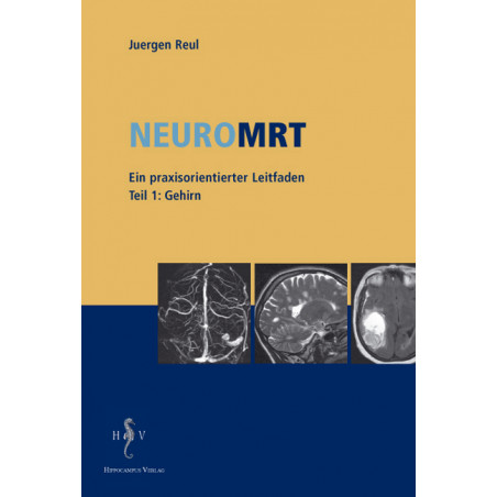 Neuro MRT