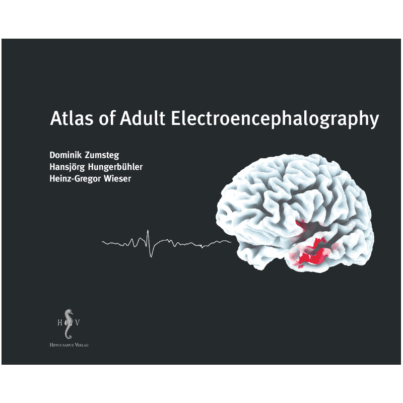 Atlas of Adult Electroencephalography