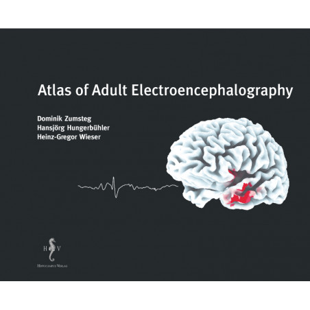 Atlas of Adult Electroencephalography